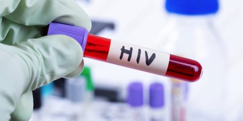 HIV ကို ဘယ်တုန်းကစပြီးတွေ့ကြတာလဲ?